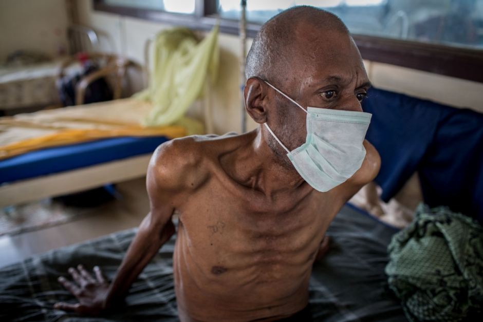 8 Deadly Diseases In South Africa That Kill More Than Ebola